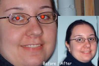 Red Eye Reduction